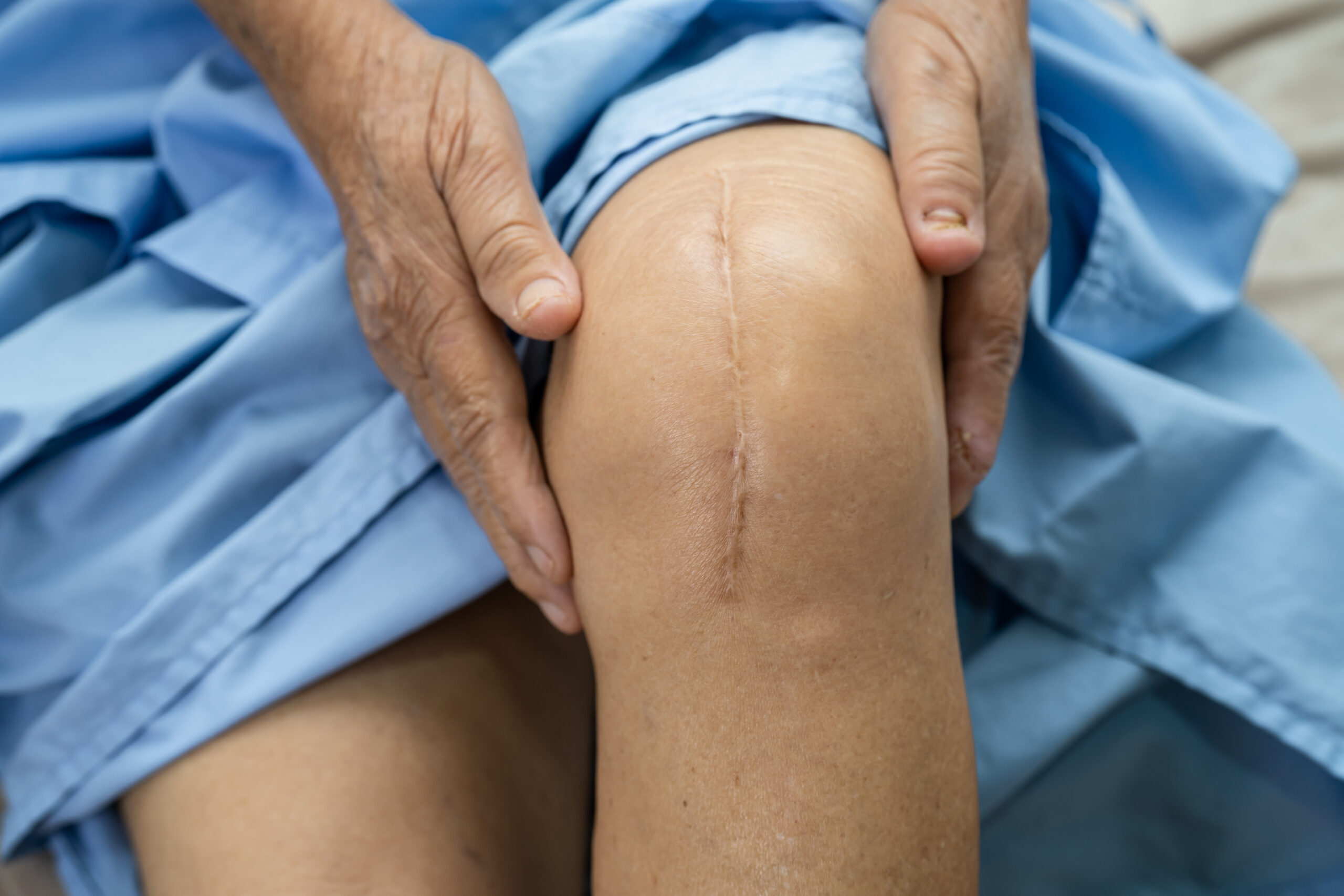 Specialist rehabilitating scar tissue on a knee joint with clinical bodywork in Colorado Springs CO.